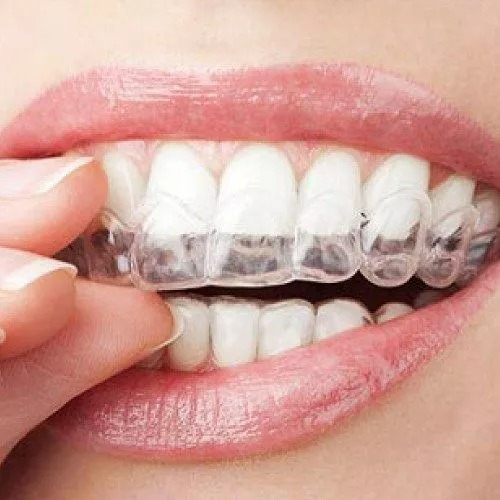 How To Take Care Of Your Braces